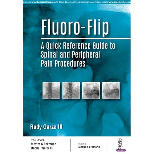 Fluoro-Flip: A Quick Reference Guide to Spinal and Peripheral Pain Procedures 1st Edition