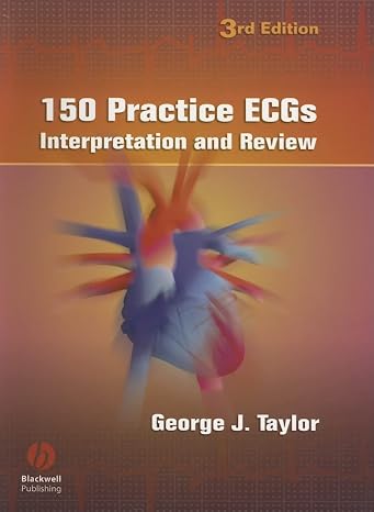 150 Practice ECGs: Interpretation and Review
