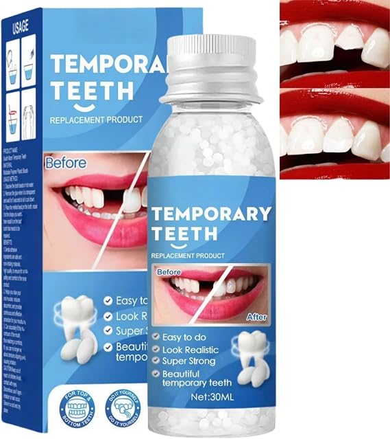 Temporary Tooth Filling Tooth Filling Repair Kit,False Teeth Replacement Tooth Filling Repair Kit, Fixing and Filling Teeth,Replace with False Teeth and Filler,Temporary Teeth Replacement Kit